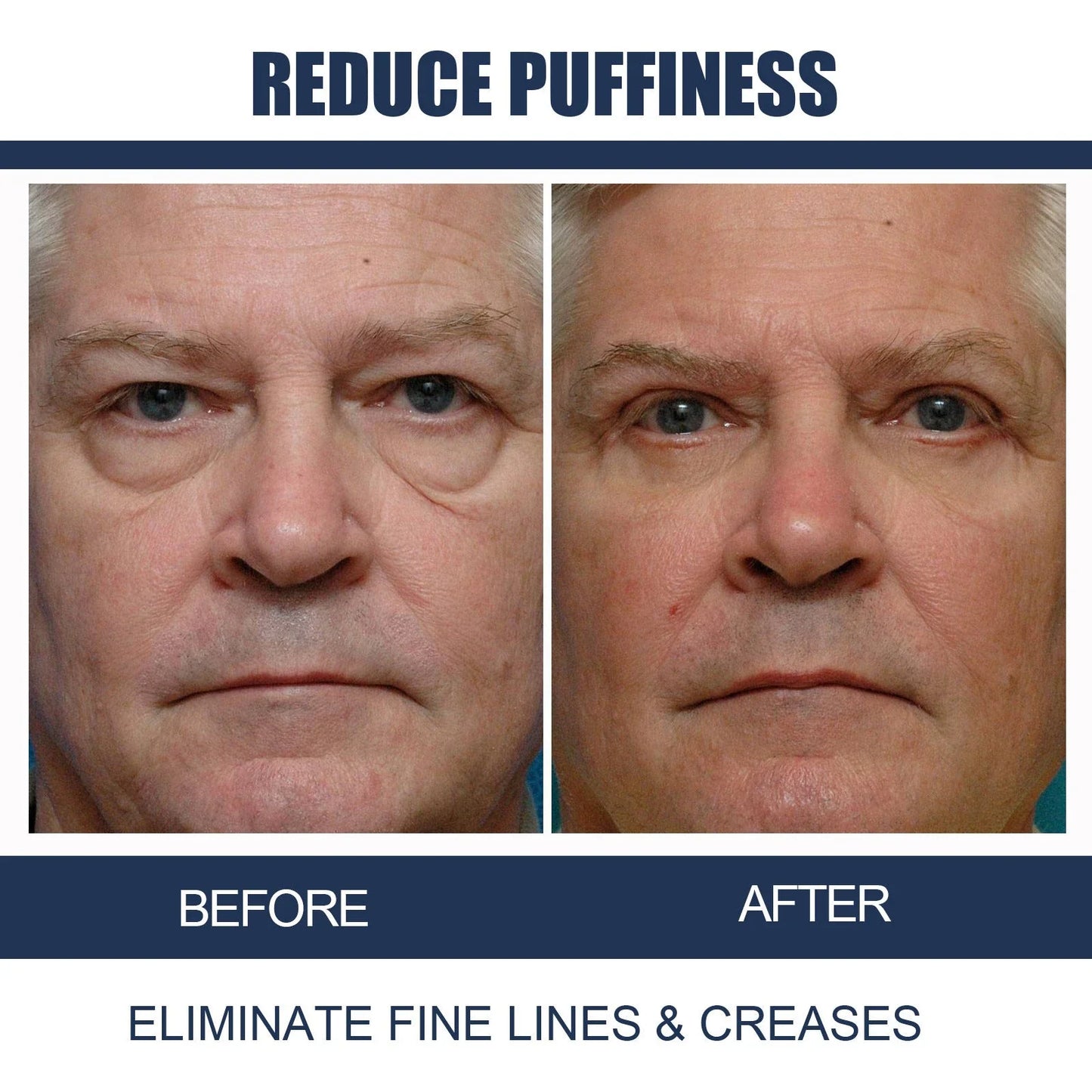 Openeyes Renewal Eye Cream – 40% OFF (Limited Time Only)