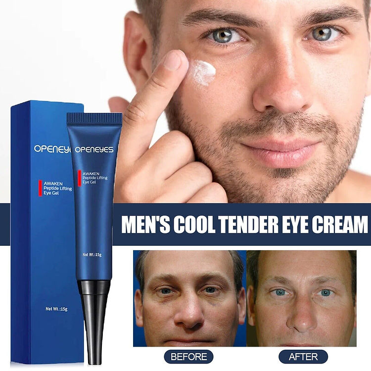 Openeyes Renewal Eye Cream – 40% OFF (Limited Time Only)