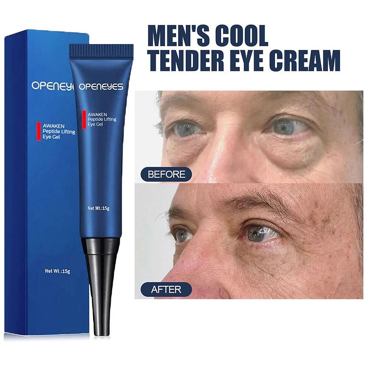 Openeyes Renewal Eye Cream – 40% OFF (Limited Time Only)