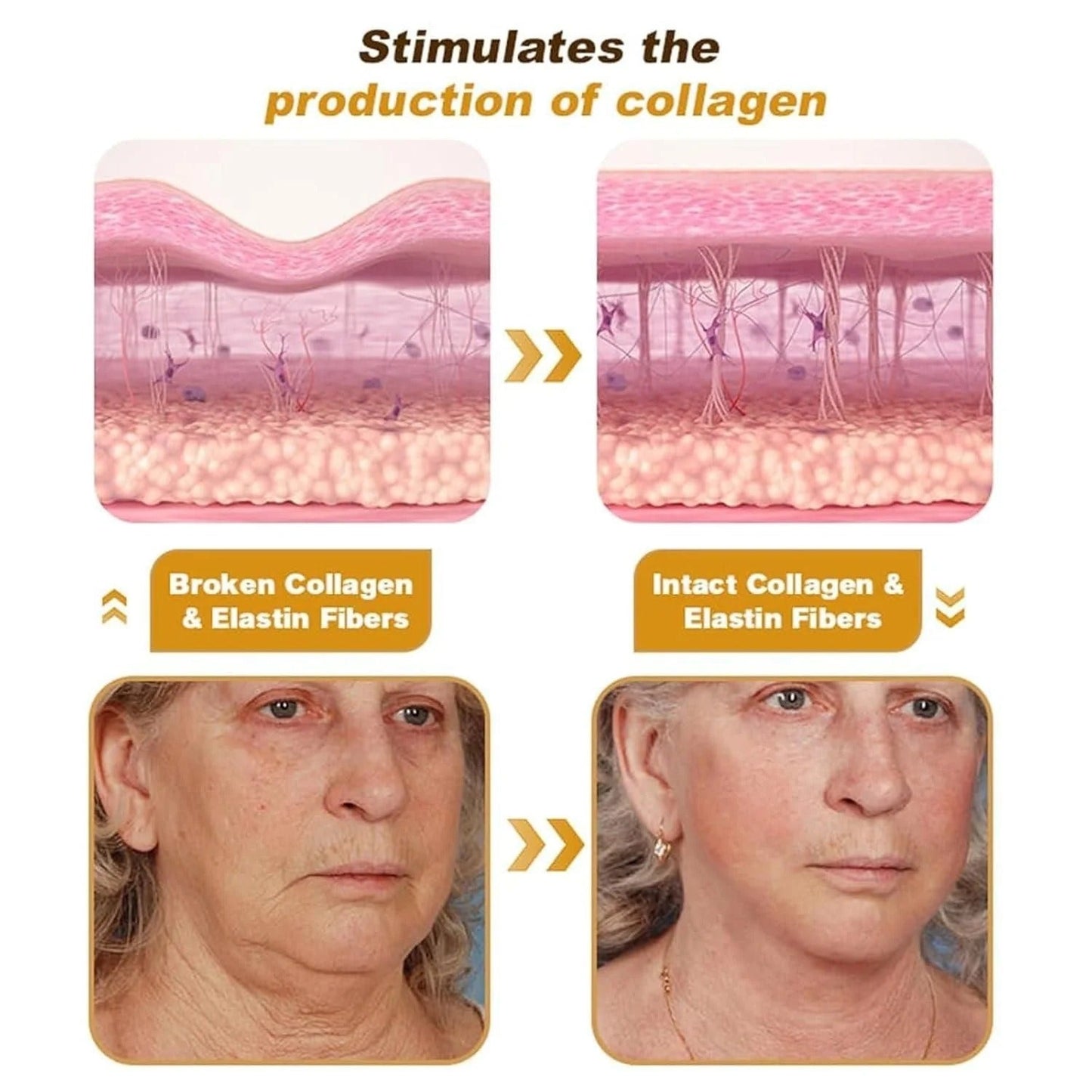 (buy 1 Get 1 Free)Bee Venom Botox Wrinkle Repair Cream